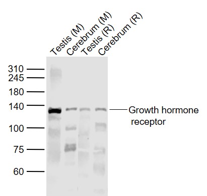1 - Growth hormone receptor Rabbit pAb AP52113