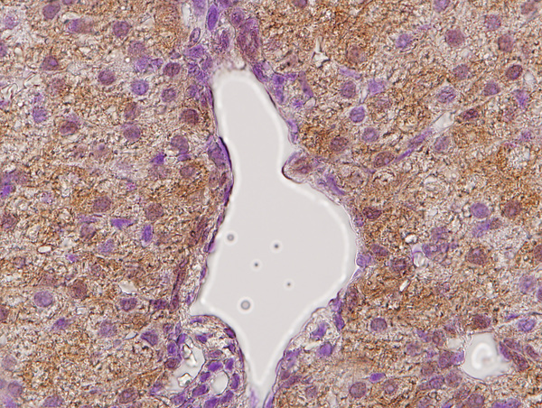 14 - Growth hormone receptor Rabbit pAb AP52113
