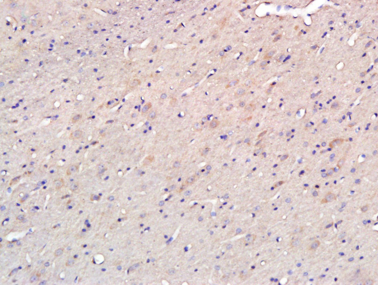 14 - Osteopontin Rabbit pAb AP52114