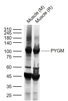 1 - PYGM Rabbit pAb AP52115