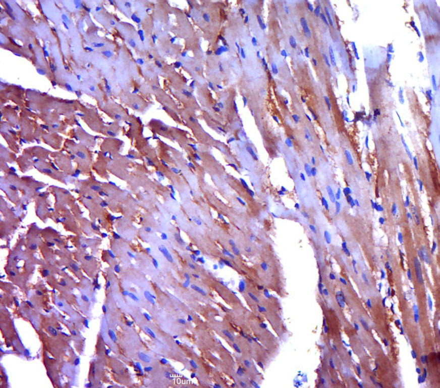 14 - PYGM Rabbit pAb AP52115