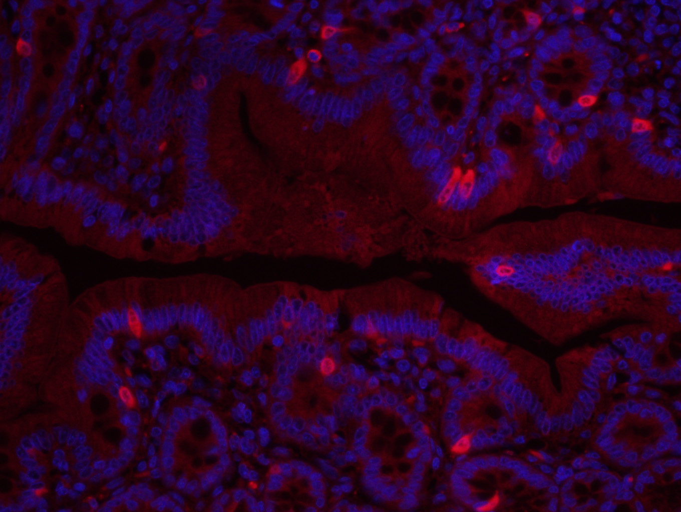 3 - Fibronectin/FN1 Rabbit pAb AP52116