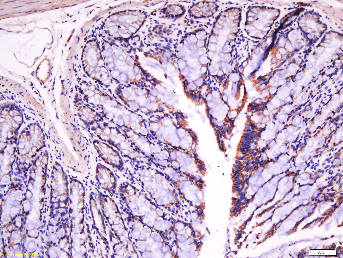 14 - Fibronectin/FN1 Rabbit pAb AP52116