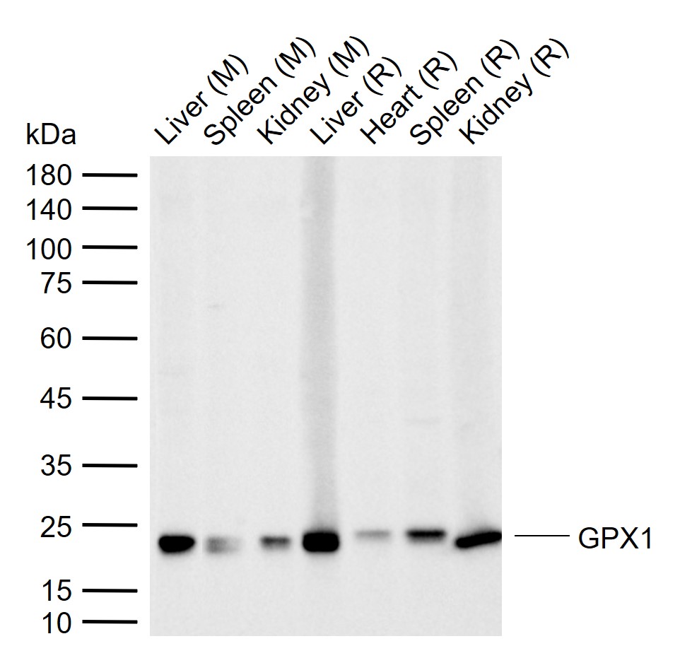 1 - GPX1 Rabbit pAb AP52117