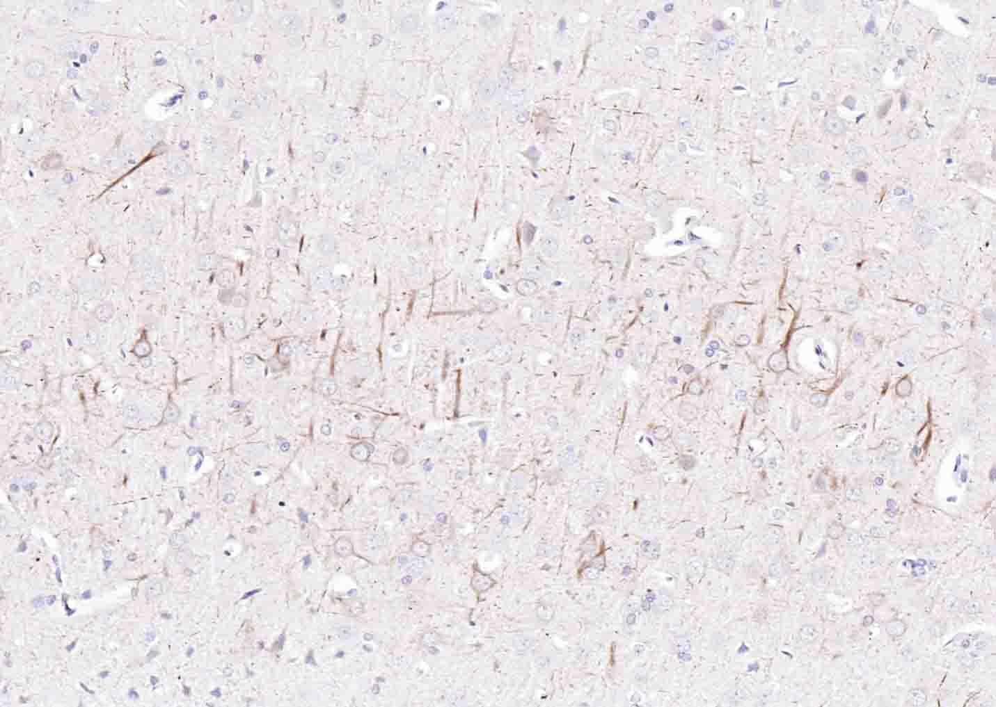 14 - NF-H Rabbit pAb AP52119
