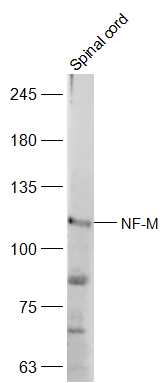 1 - NF-M Rabbit pAb AP52122