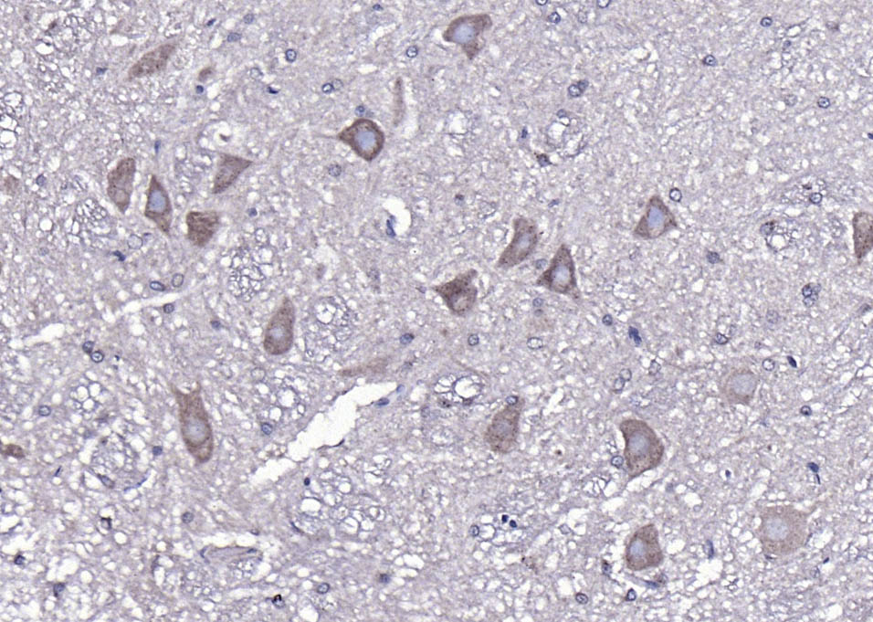 14 - NF-M Rabbit pAb AP52122