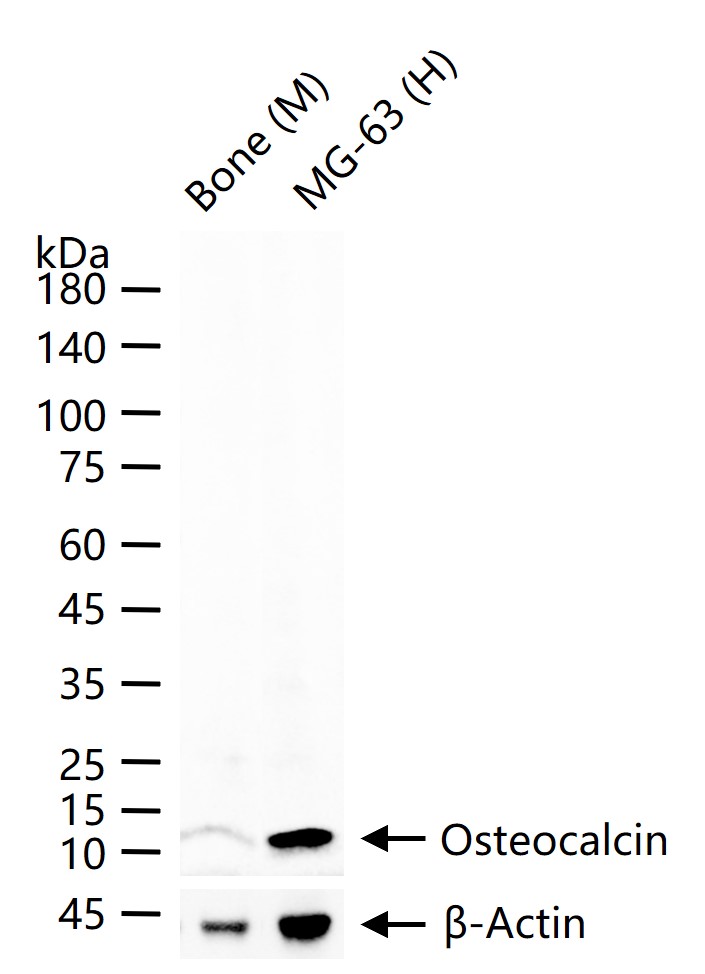 1 - Osteocalcin Rabbit pAb AP52123