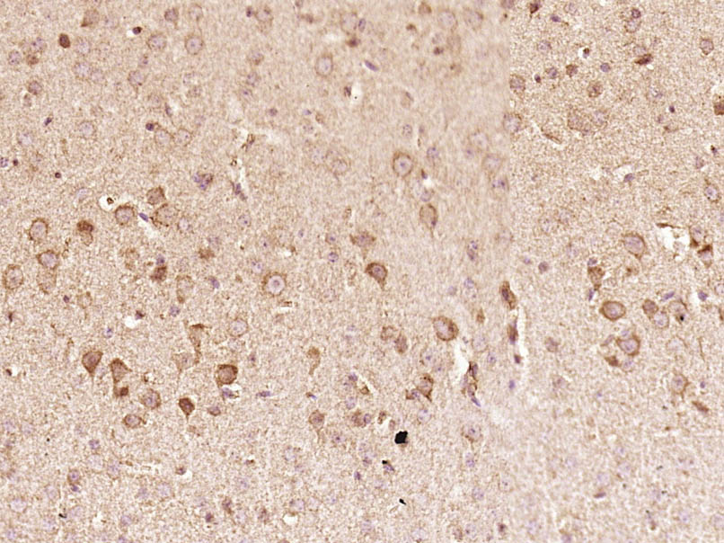 14 - RANTES Rabbit pAb AP52124