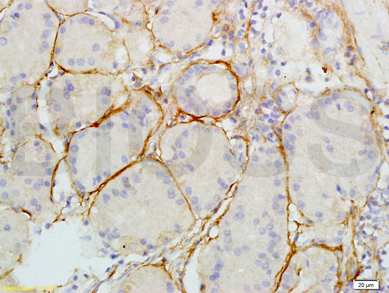 14 - Collagen XI alpha 2 Rabbit pAb AP52128