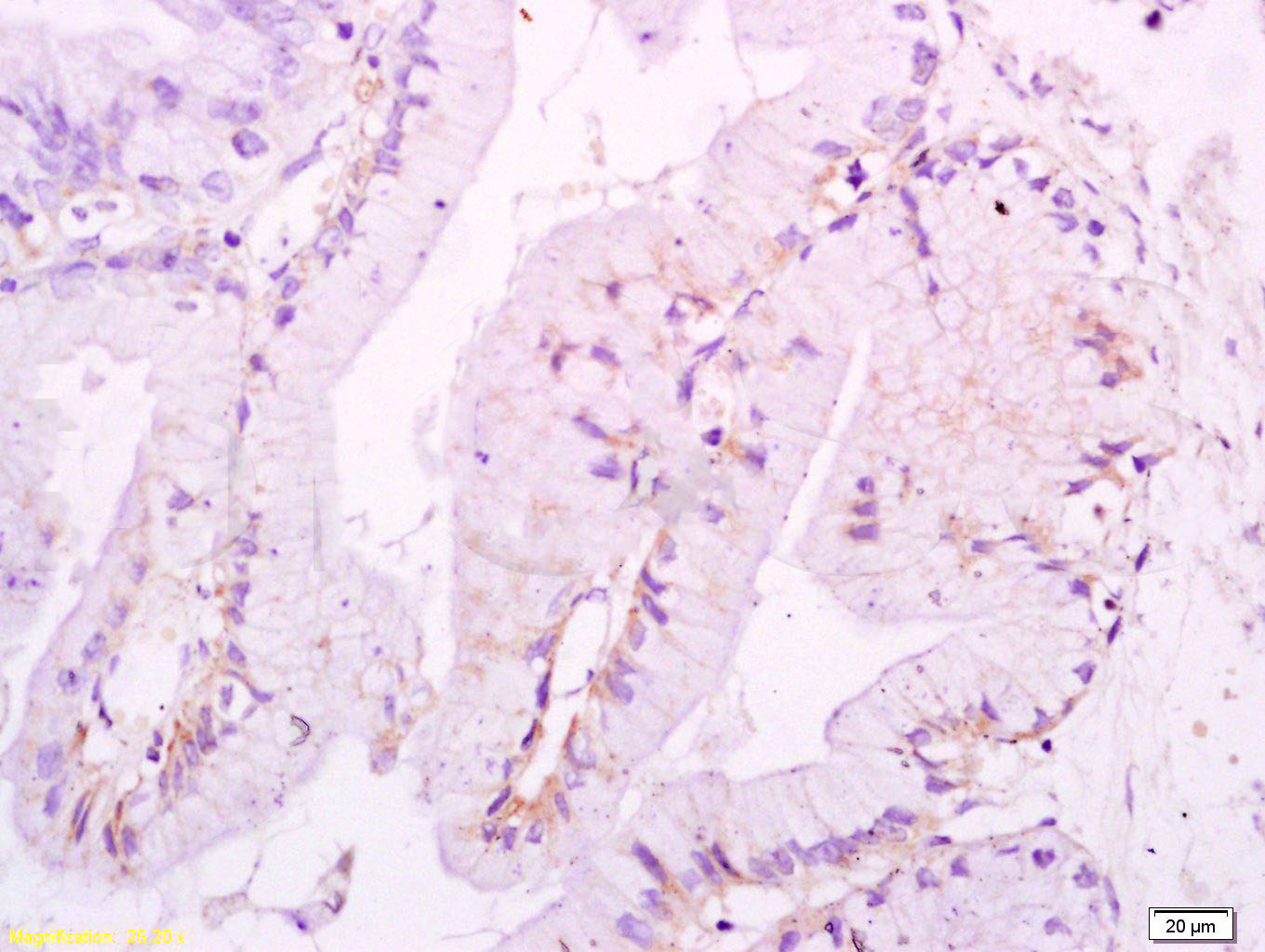 14 - Ezrin/Radixin Rabbit pAb AP52132