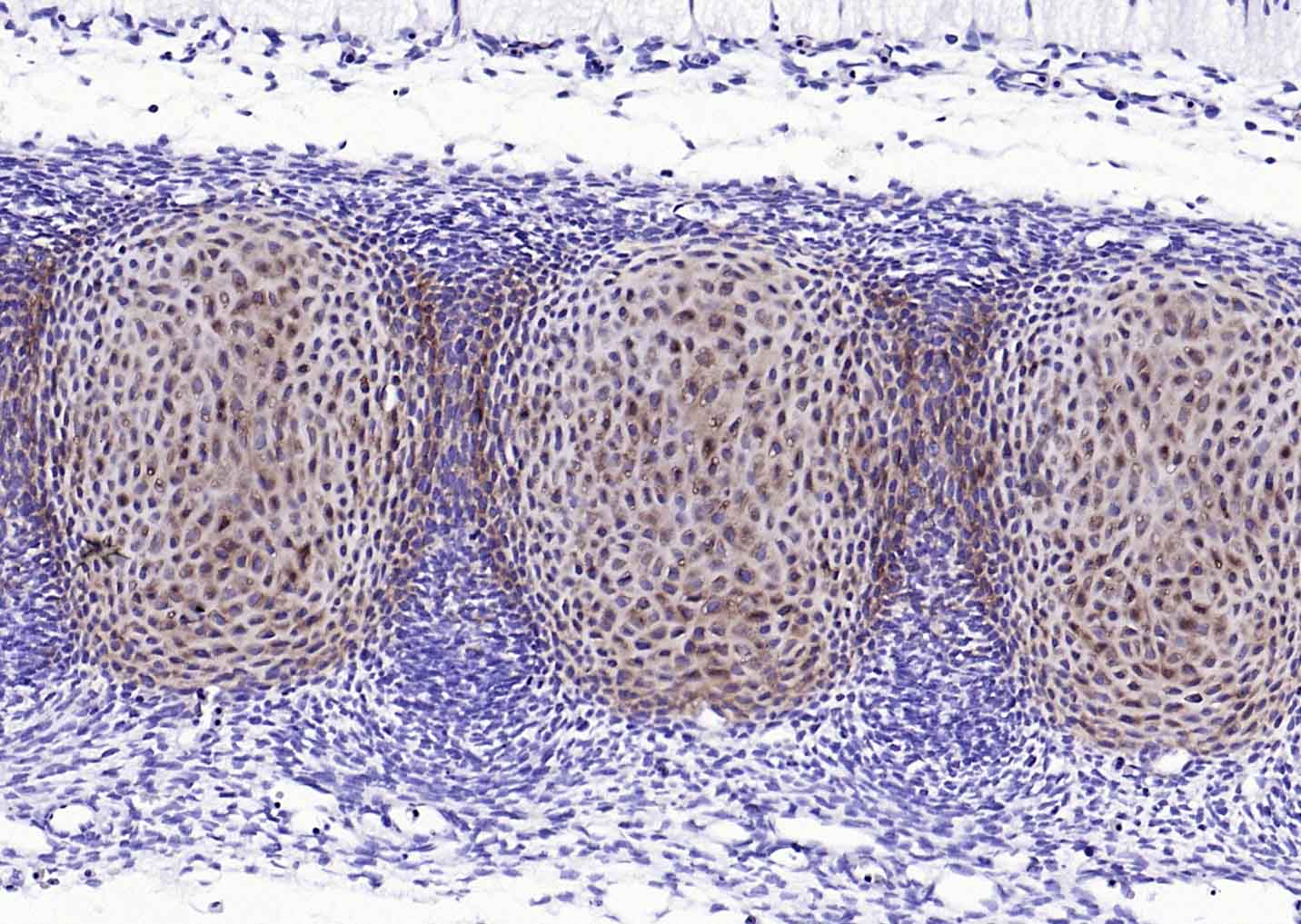 14 - ACAN Rabbit pAb AP52137