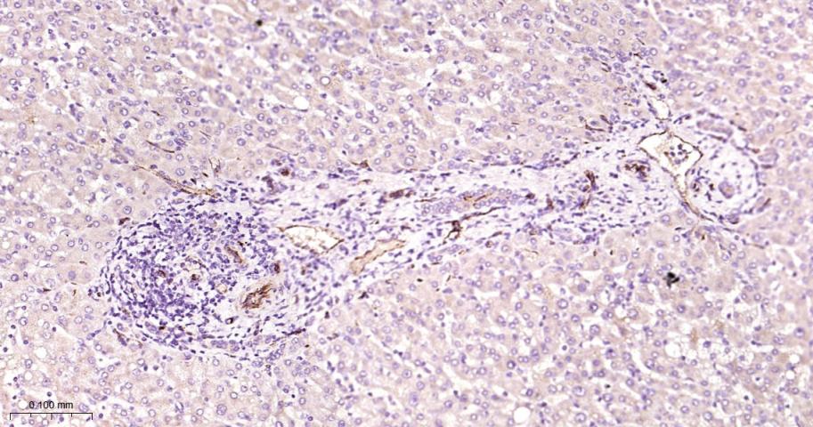 14 - CD31 Rabbit pAb AP52138