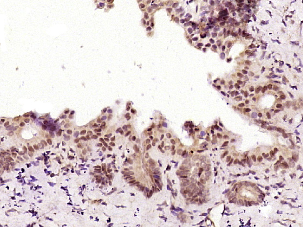 14 - phospho-PKC alpha (Thr638) Rabbit pAb AP52142