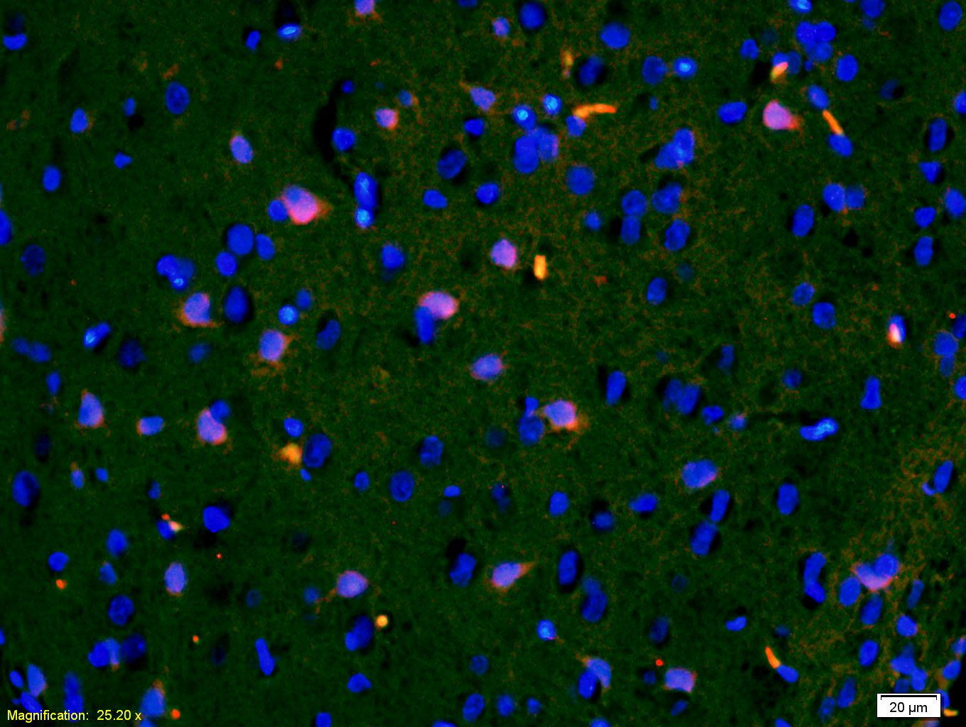 3 - IGFBP3 Rabbit pAb AP52144