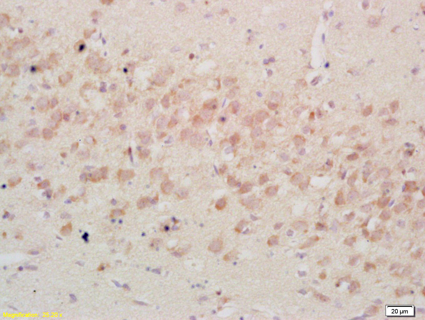 14 - IGFBP3 Rabbit pAb AP52144