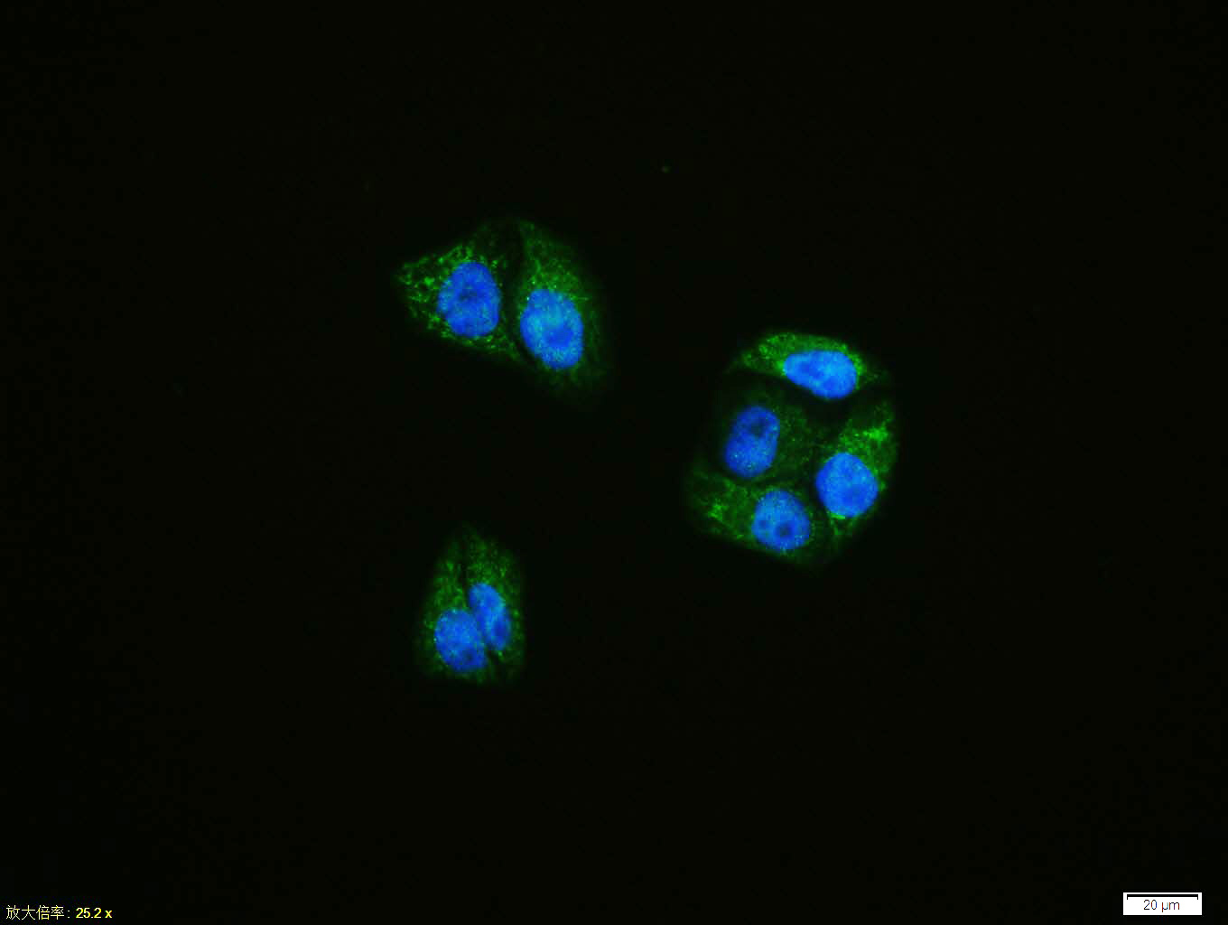 0 - ATF6 Rabbit pAb AP52147