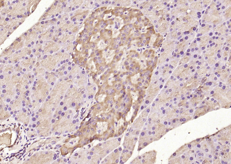 14 - ATF6 Rabbit pAb AP52147