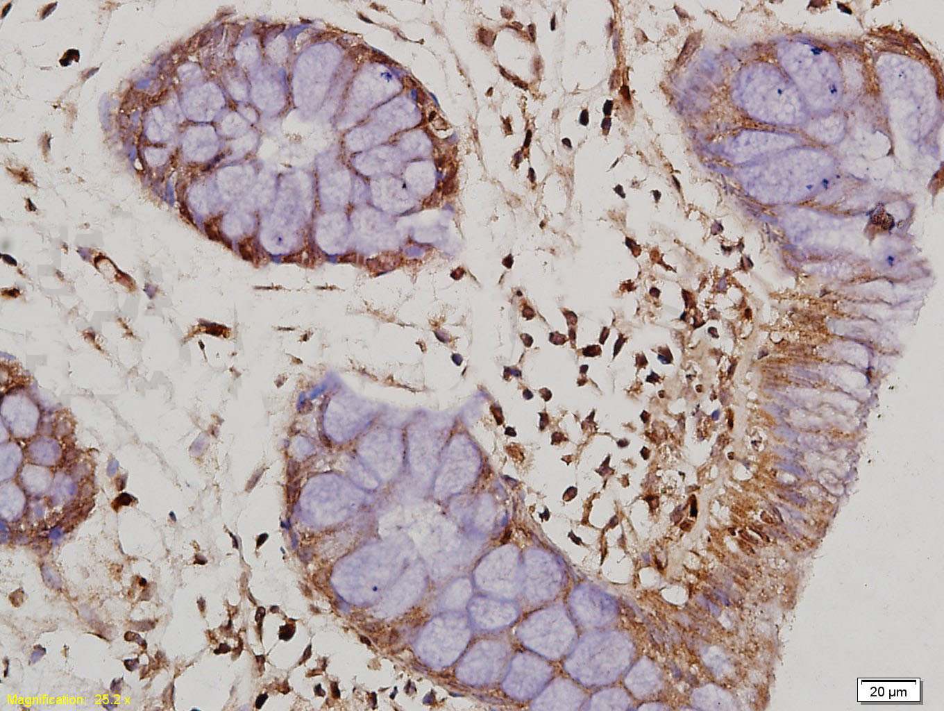 14 - IL-10 Rabbit pAb AP52148