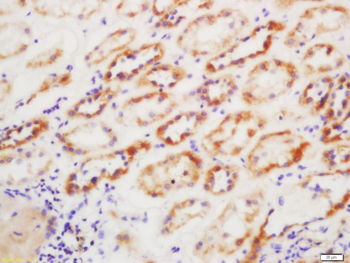 14 - GSTP1 Rabbit pAb AP52151