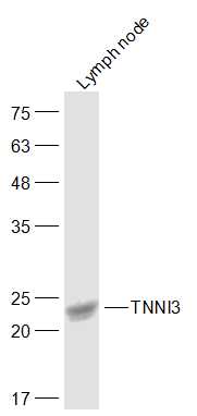 1 - Cardiac Troponin I/TNNC1 Rabbit pAb AP52153