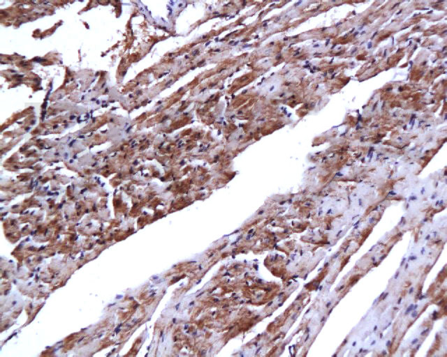 14 - Cardiac Troponin I/TNNC1 Rabbit pAb AP52153