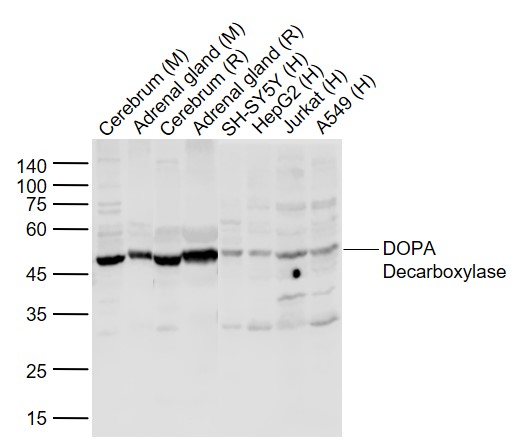 1 - DOPA Decarboxylase Rabbit pAb AP52155