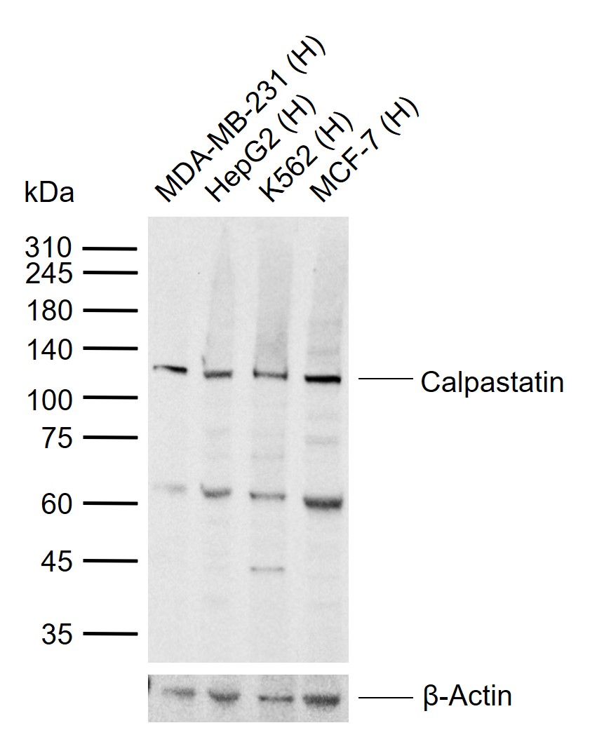 1 - Calpastatin Rabbit pAb AP52156