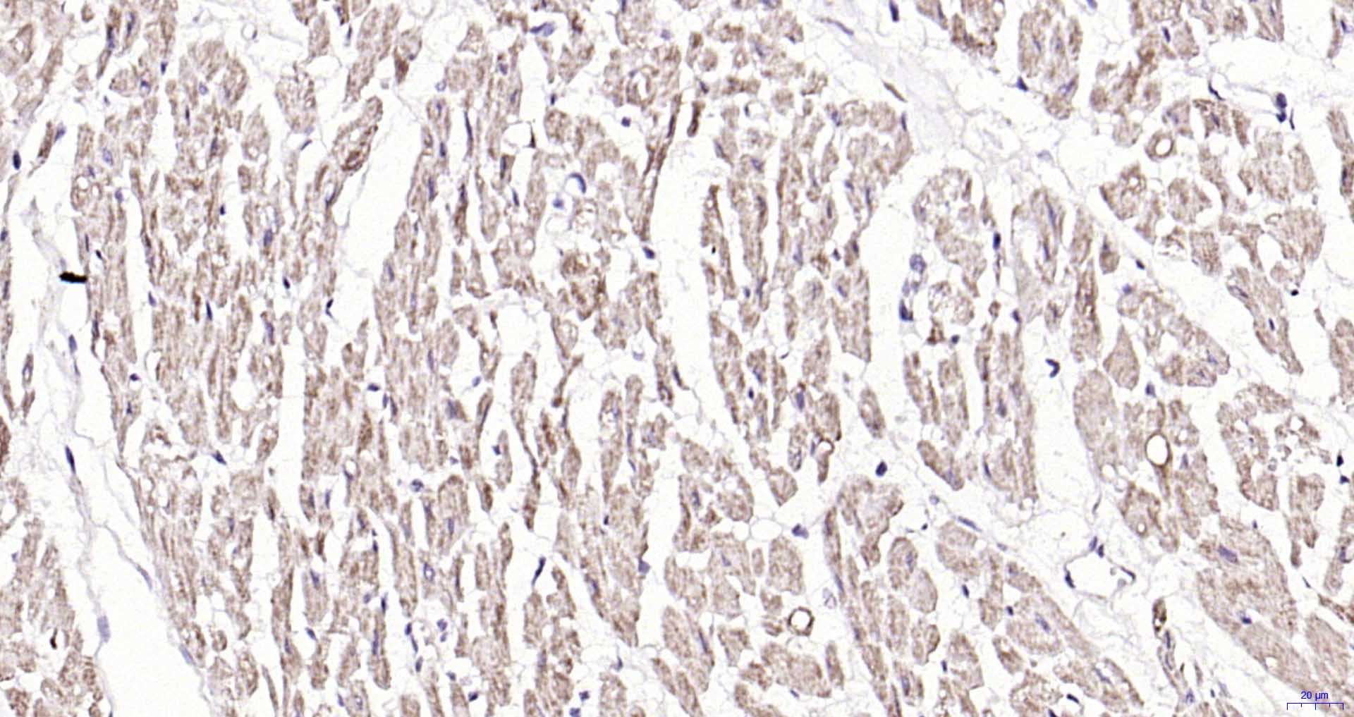 14 - Calpastatin Rabbit pAb AP52156