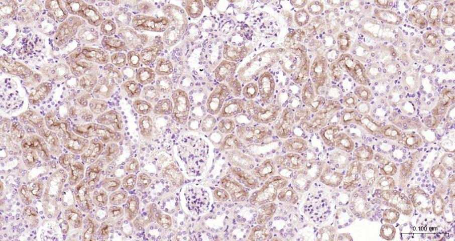 14 - MDR1 Rabbit pAb AP52159