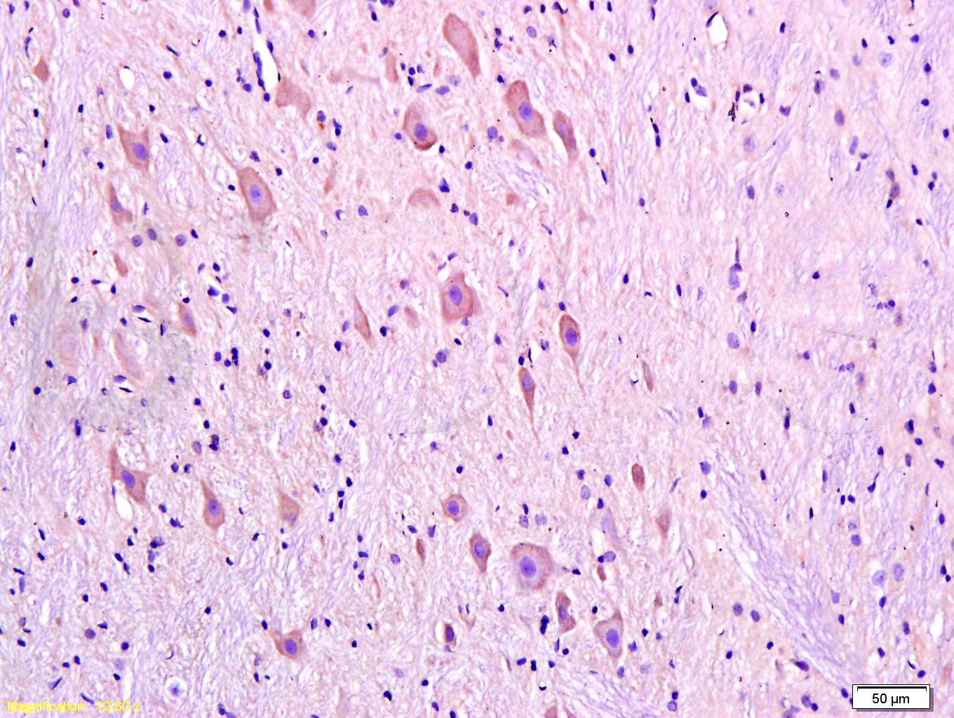 14 - DRD1 Rabbit pAb AP52160