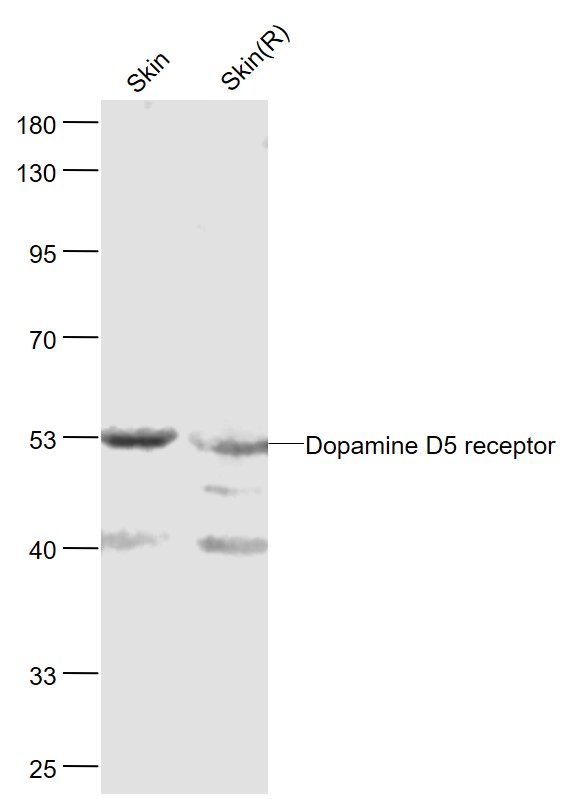 1 - Dopamine D5 receptor Rabbit pAb AP52162