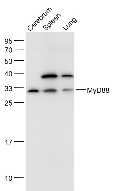 1 - MyD88 Rabbit pAb AP52164