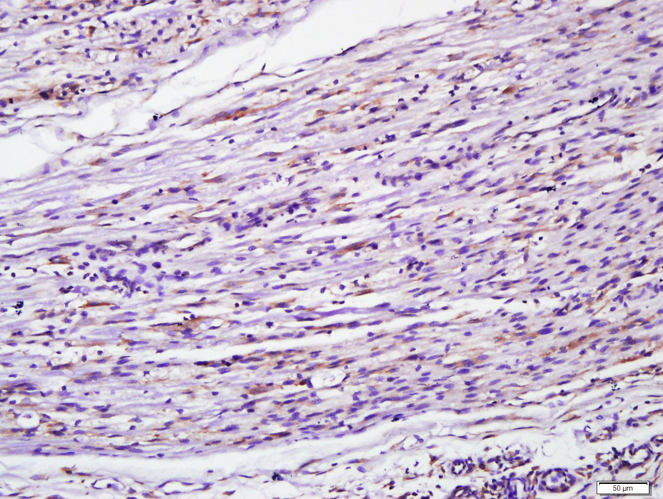 14 - MyD88 Rabbit pAb AP52164