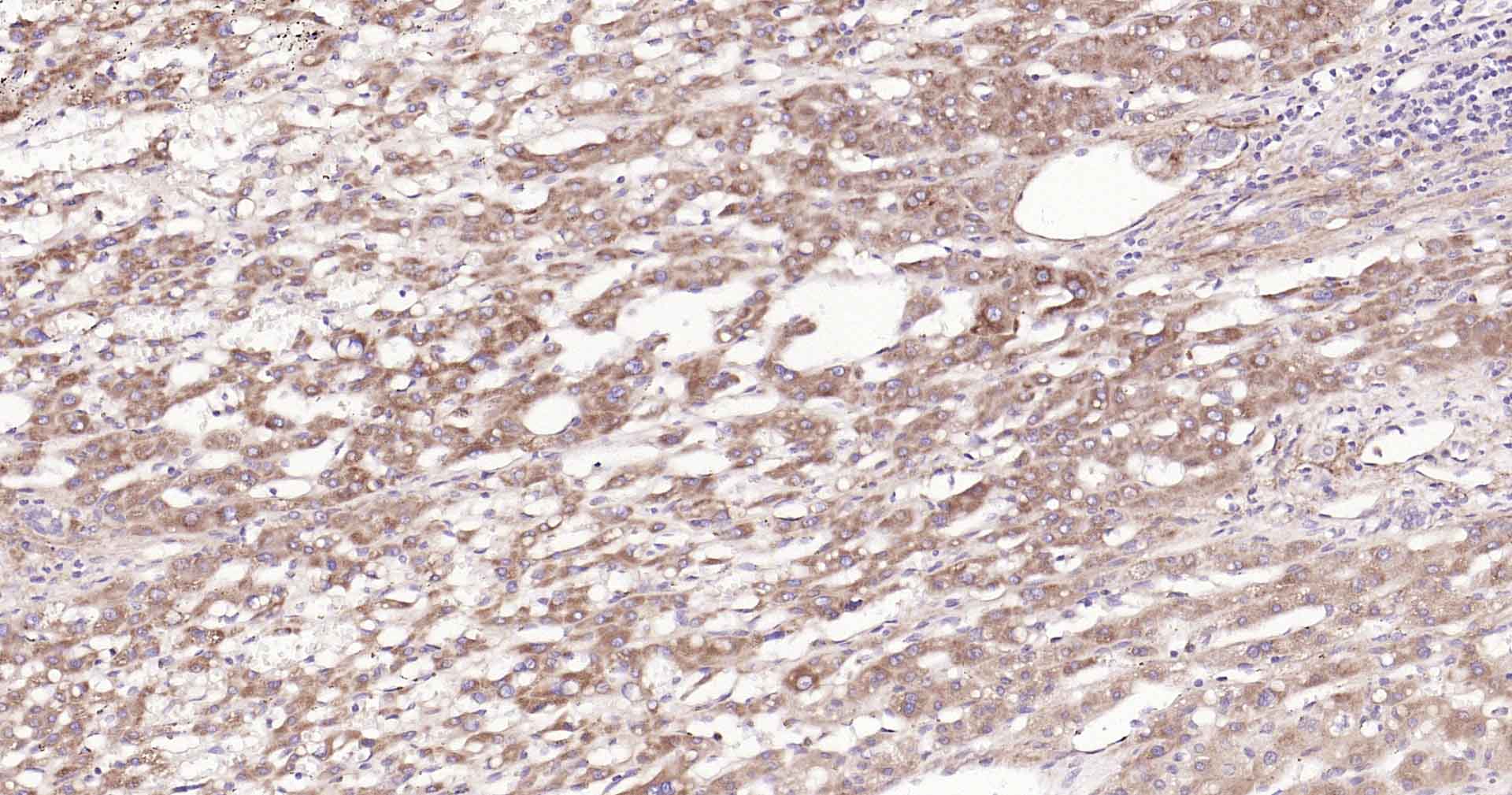 14 - CYP7A1 Rabbit pAb AP52166