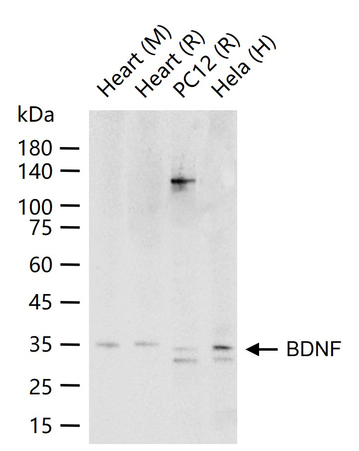 1 - BDNF Rabbit pAb AP52169