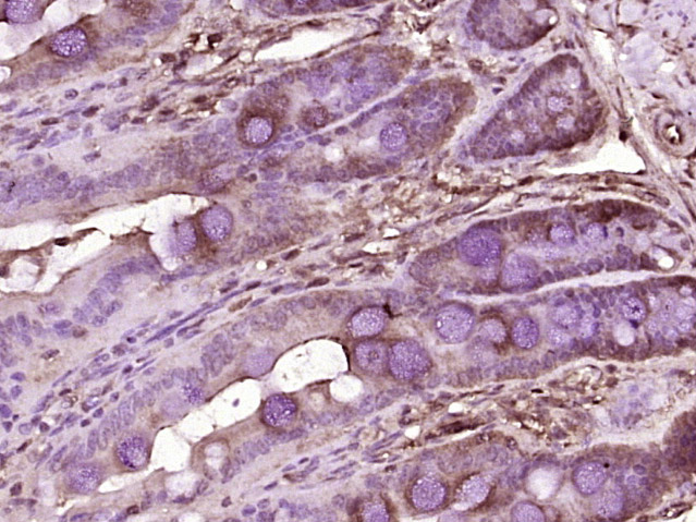 14 - DPP4/CD26 Rabbit pAb AP52175