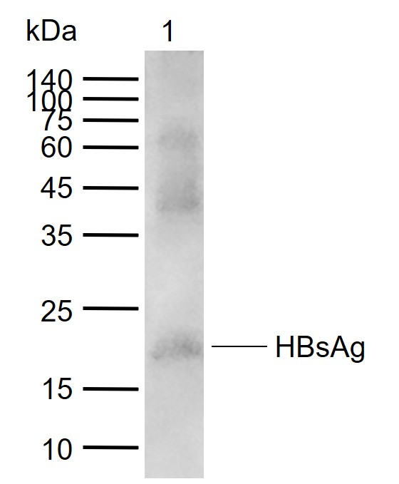 1 - HBsAg Goat pAb AP52176