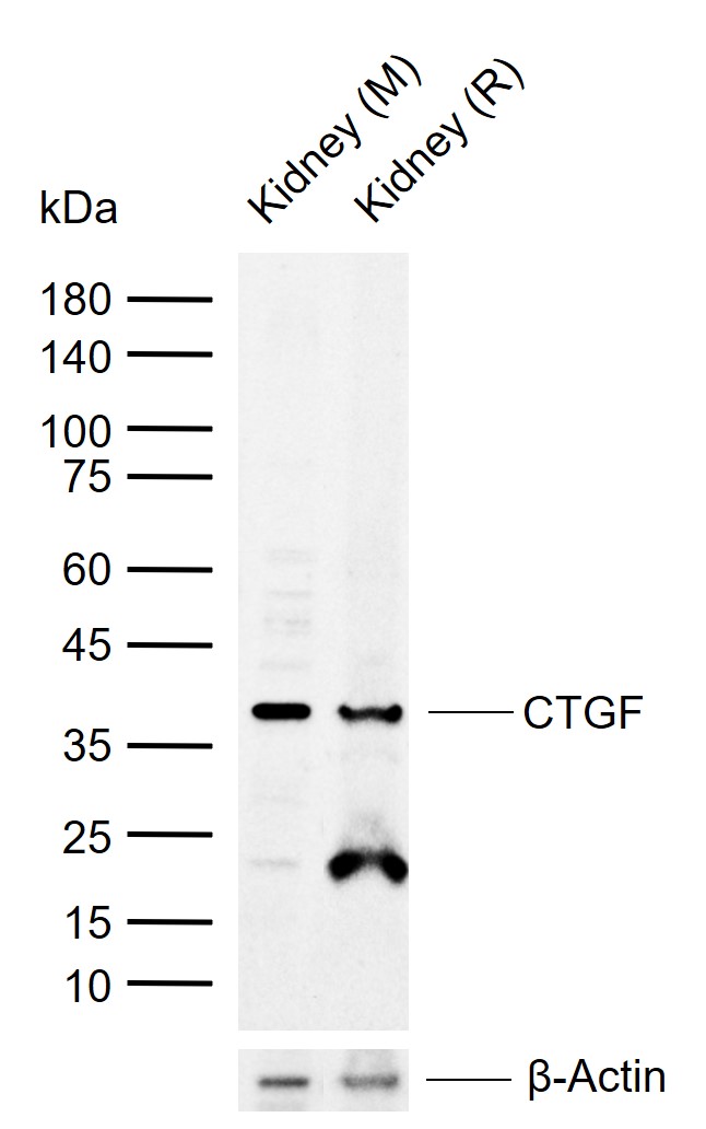 1 - CTGF Rabbit pAb AP52180