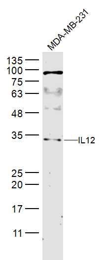 1 - IL12A Rabbit pAb AP52181
