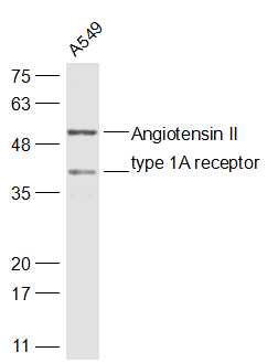 1 - Angiotensin II type 1A receptor Rabbit pAb AP52185