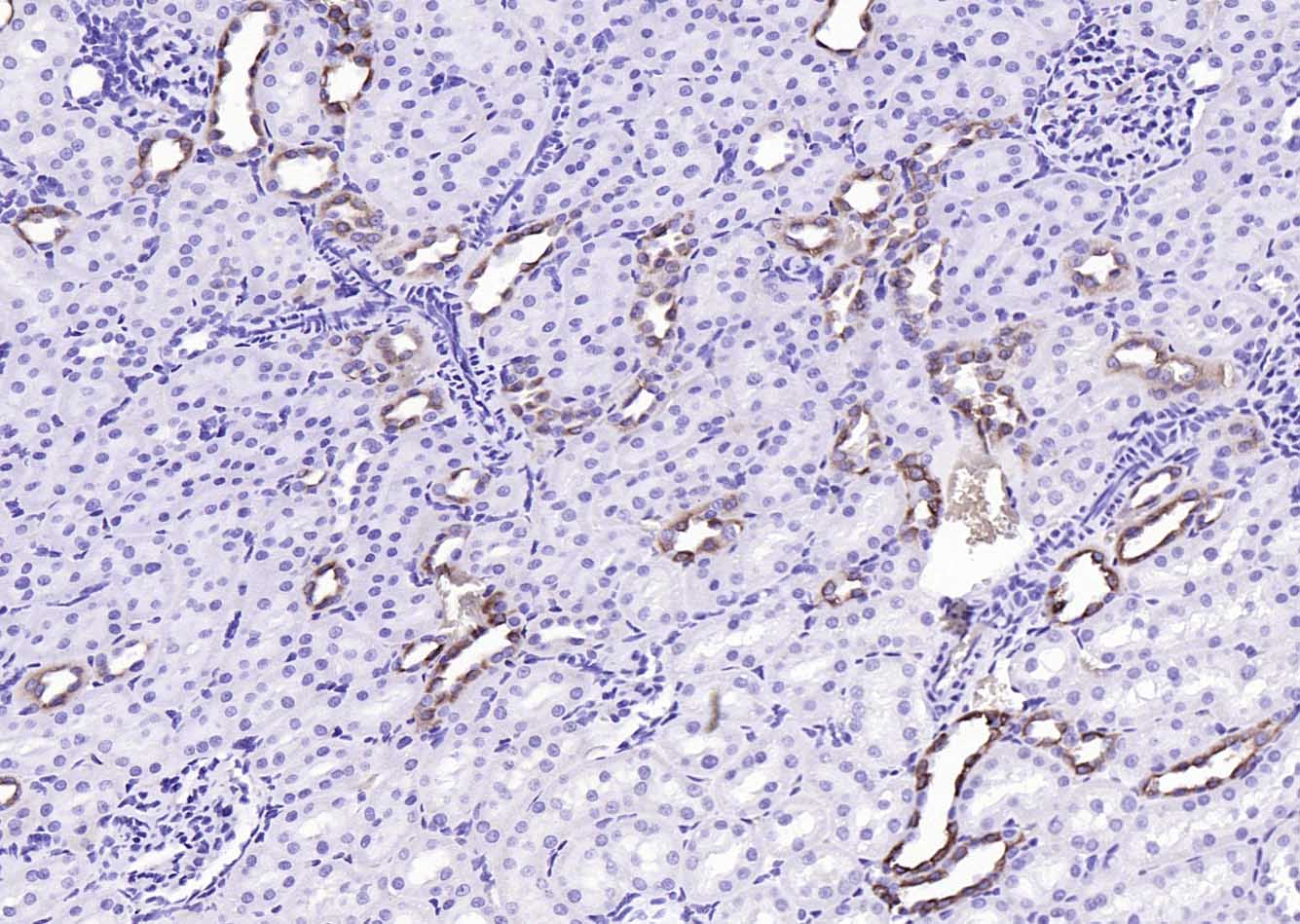14 - Angiotensin II type 1A receptor Rabbit pAb AP52185