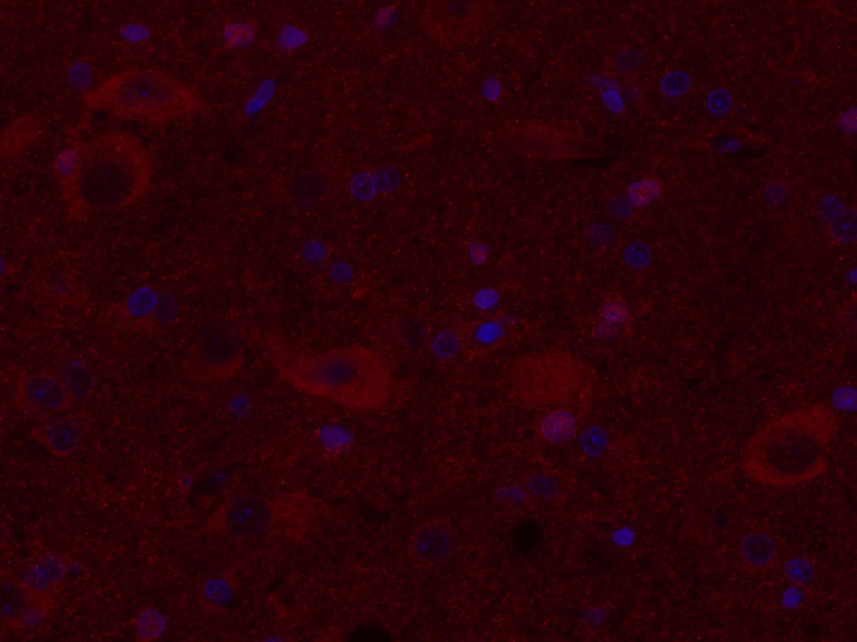 3 - Dopamine D3 receptor Rabbit pAb AP52186
