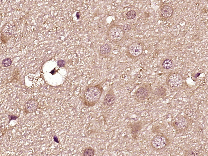 14 - Dopamine D3 receptor Rabbit pAb AP52186