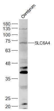 1 - Serotonin transporter Rabbit pAb AP52188