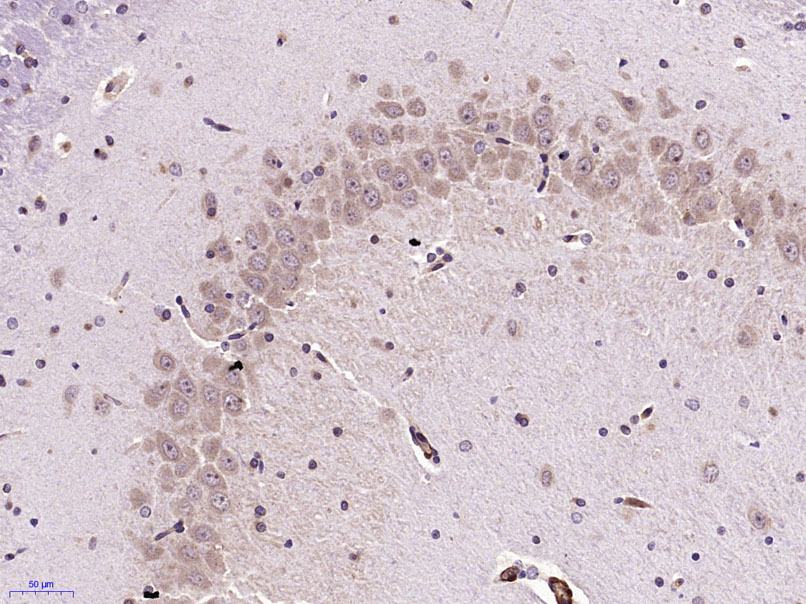 14 - Serotonin transporter Rabbit pAb AP52188