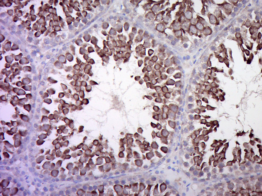 14 - Calcitonin receptor Rabbit pAb AP52190