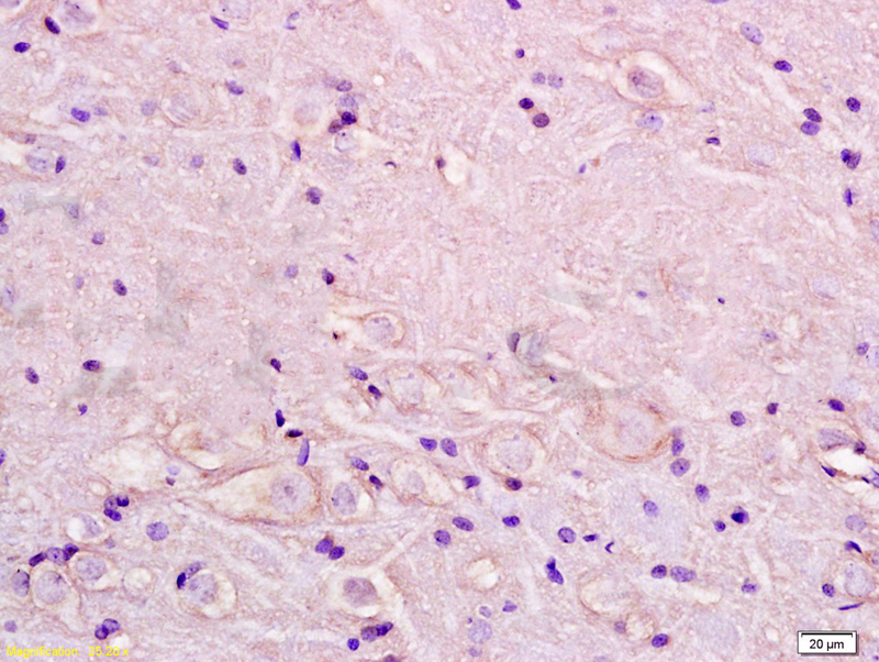 14 - ADRA1A Rabbit pAb AP52193