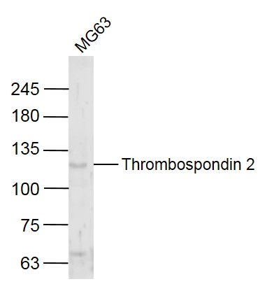 1 - Thrombospondin 2 Rabbit pAb AP52195
