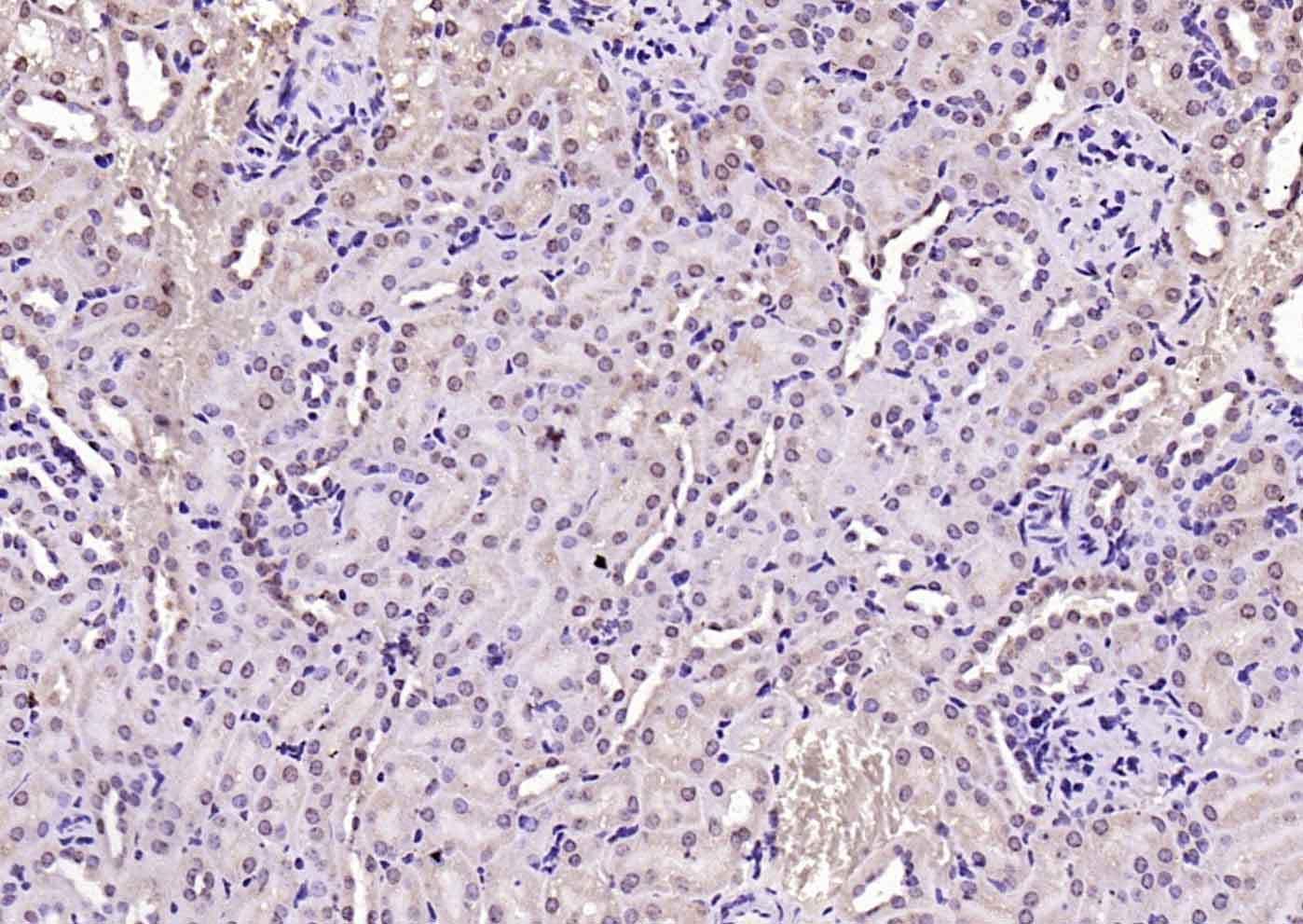 14 - VEGFR3 Rabbit pAb AP52197